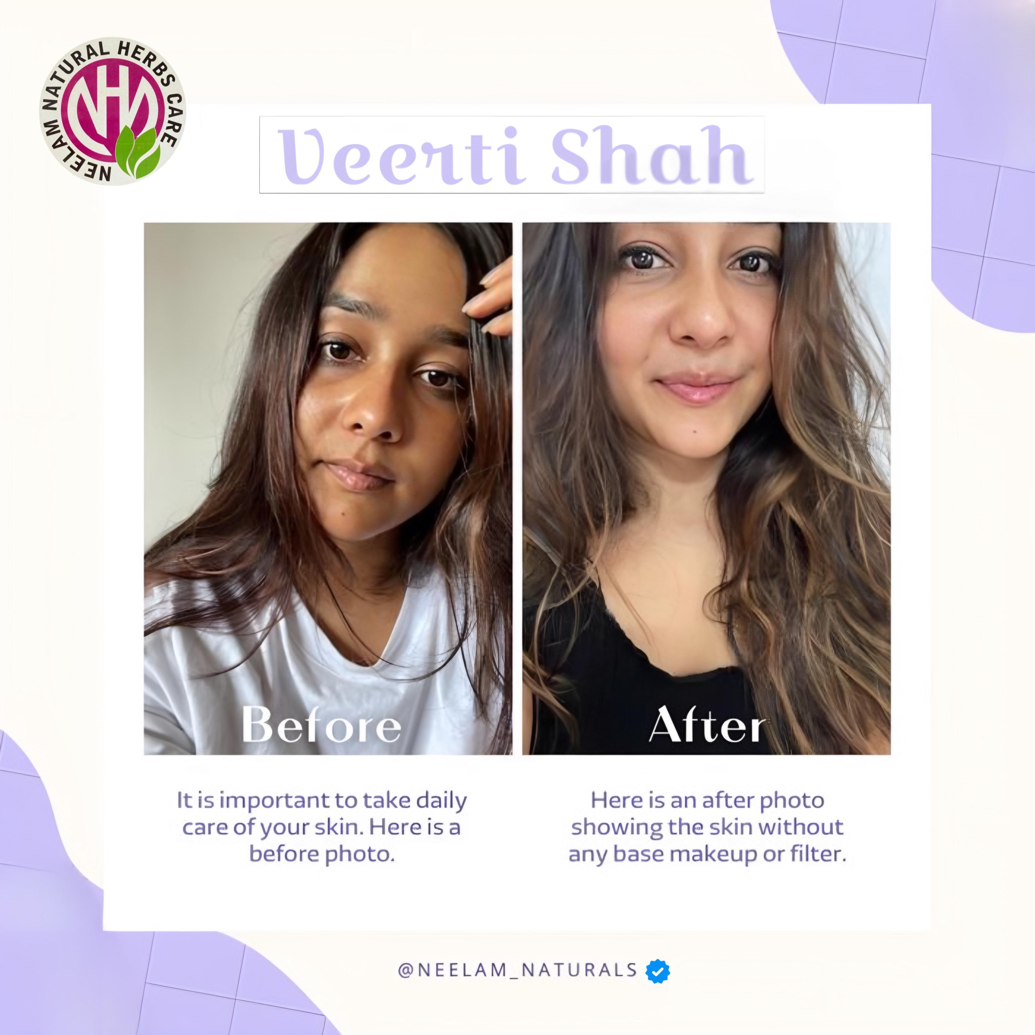 Patient Transformation 1