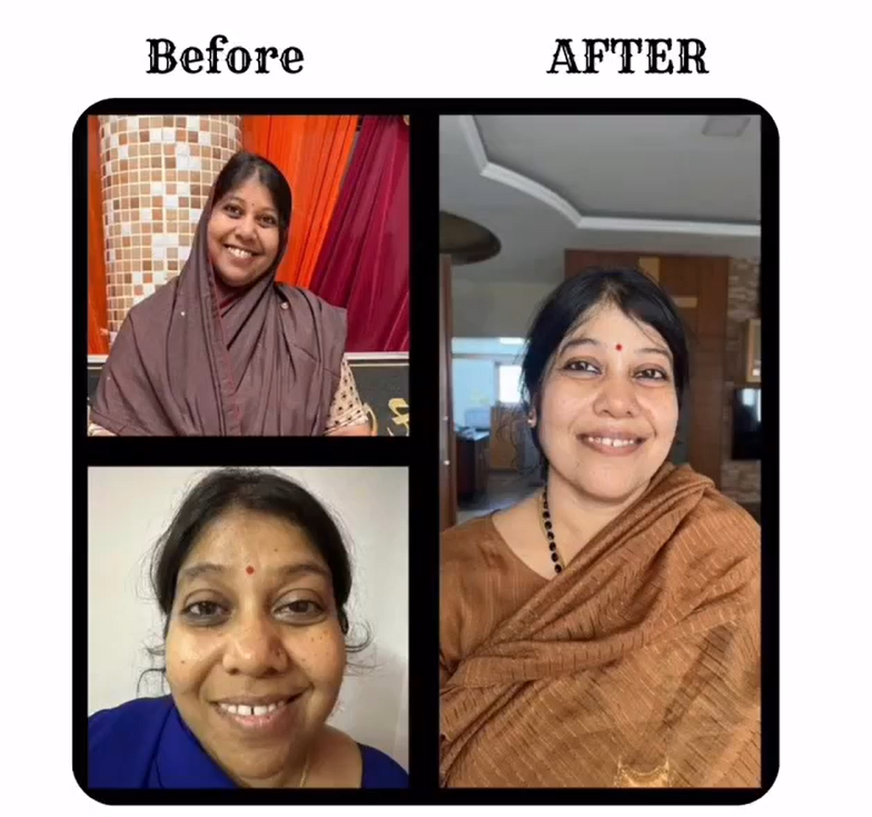 Patient Transformation 3